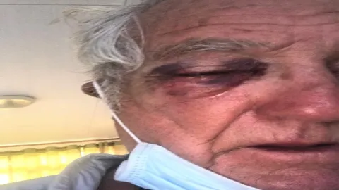 صورة سائح تعرض للضرب في فرنسا